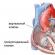 Omandatud südamedefektid Täiskasvanute omandatud südamedefektid põhjustavad