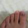 تحول الظفر إلى اللون الأزرق في إصبع القدم الكبير: الأعراض والأسباب والعلاج الظفر أزرق اللون ويتقشر