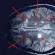 What brain pathologies does MRI show?